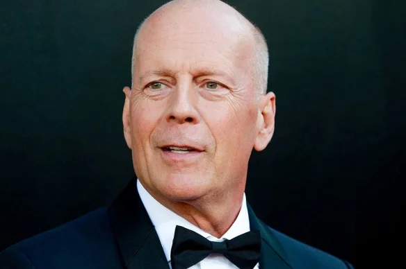 Bruce Willis was diagnosed with aphasia, he decided to quit acting career!