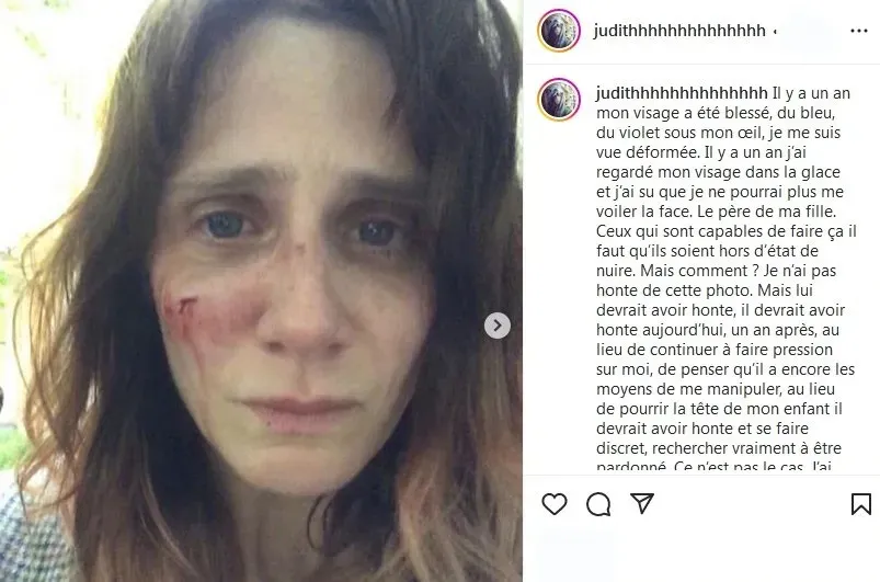 Judith Chemla recently accused her ex-boyfriend Yohan Manca of domestic violence and long-term harassment on Instagram | FMV6