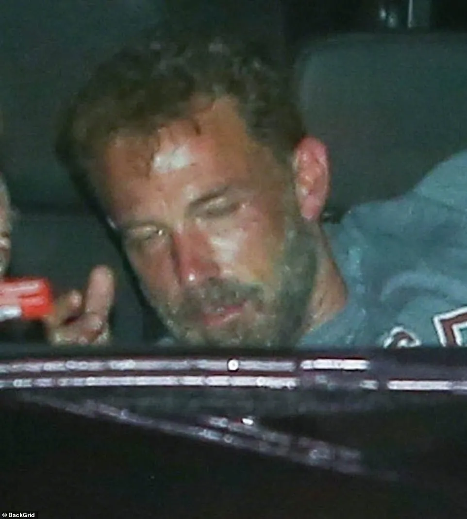 Ben Affleck dozed off on the way to the plane after his wedding | FMV6